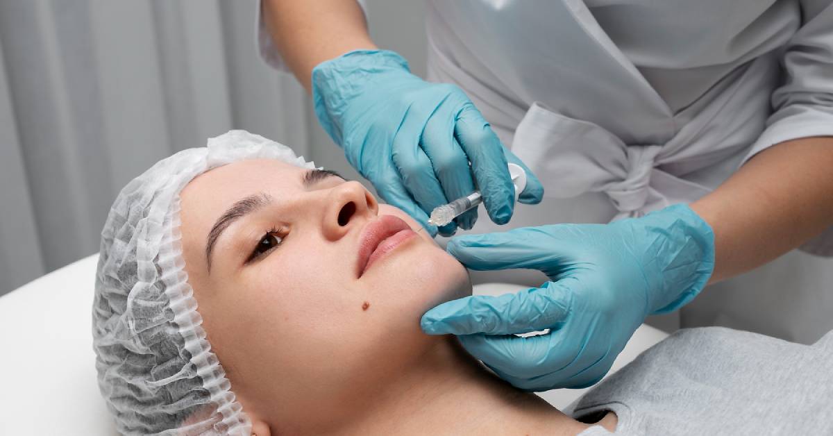 Apa Itu Filler Juvederm