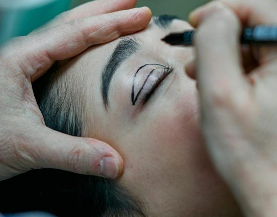 Berapa Lama Proses Penyembuhan Operasi Kelopak Mata