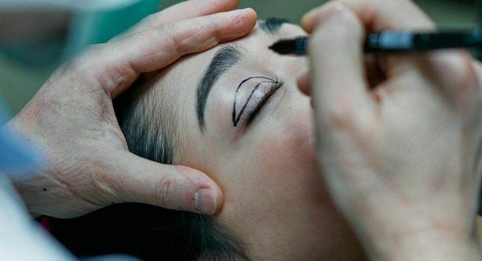 Berapa Lama Proses Penyembuhan Operasi Kelopak Mata