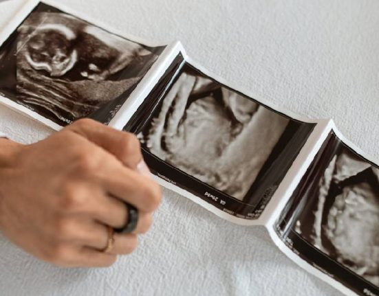 Ini 8 Syarat Bayi Tabung Sebelum Lakukan Prosedurnya