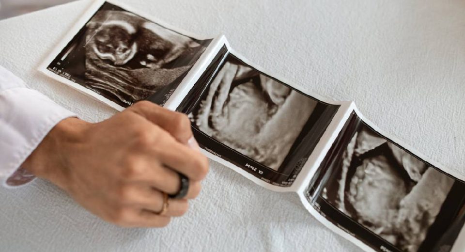 Ini 8 Syarat Bayi Tabung Sebelum Lakukan Prosedurnya