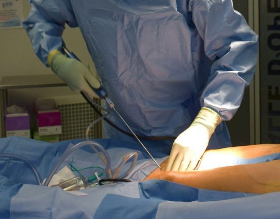Laser Liposuction