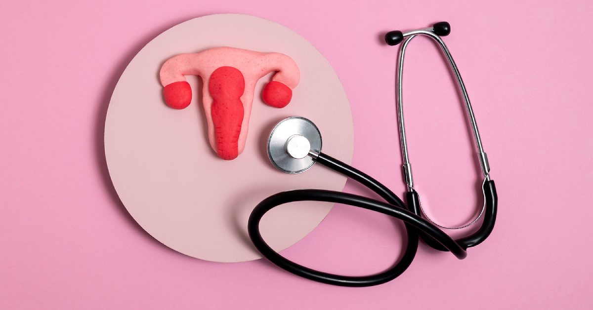 Perbedaan Endometriosis dan PCOS yang Wanita Perlu Tahu