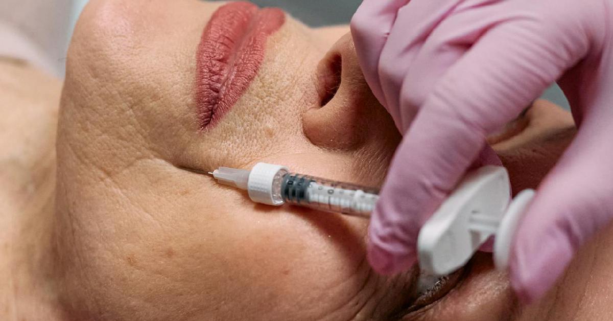 Perbedaan Filler dan Botox yang Perlu Diperhatikan