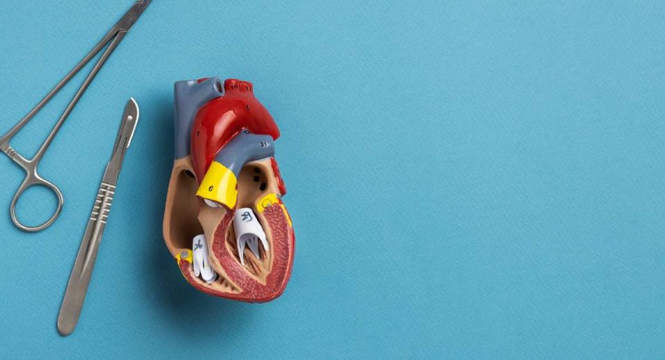 Perbedaan Kateterisasi Jantung dan Pasang Ring Jantung