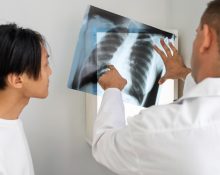 Jenis Tes untuk Deteksi Kanker Paru-paru