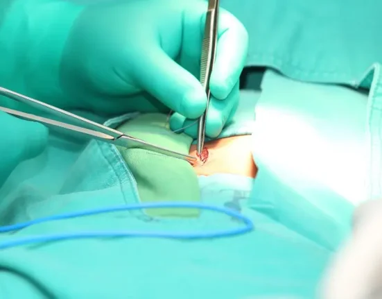 Daftar Dokter Spesialis Bedah Hernia di Singapura