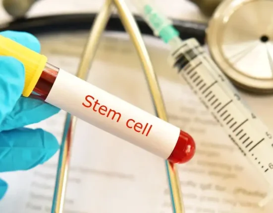 Estimasi Biaya Terapi Stem Cell di Singapura, Malaysia, dan Thailand