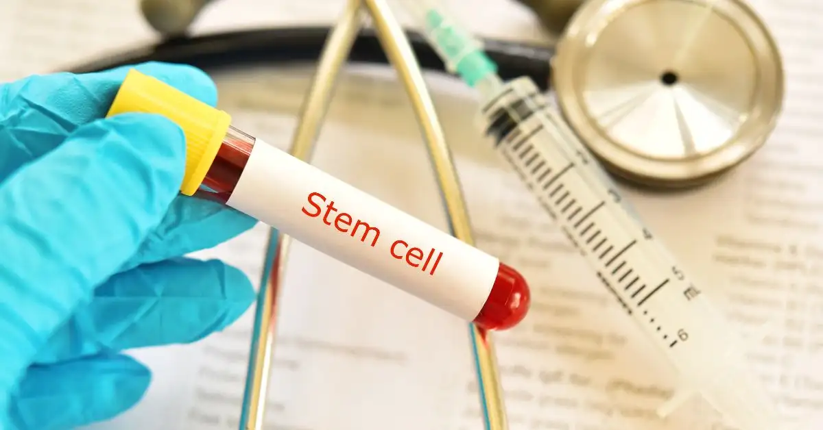 Estimasi Biaya Terapi Stem Cell di Singapura, Malaysia, dan Thailand