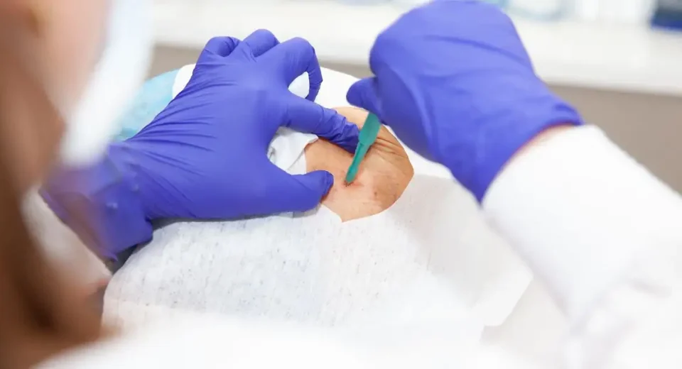 Serba-serbi Biopsi Payudara