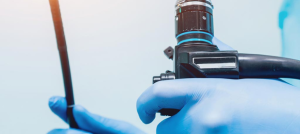 Gastroscopy-Colonoscopy-1.png