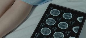 PET atau CT Scan