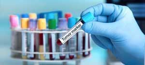 cancer-marker-test.jpg