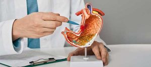 gastric-colon.jpg